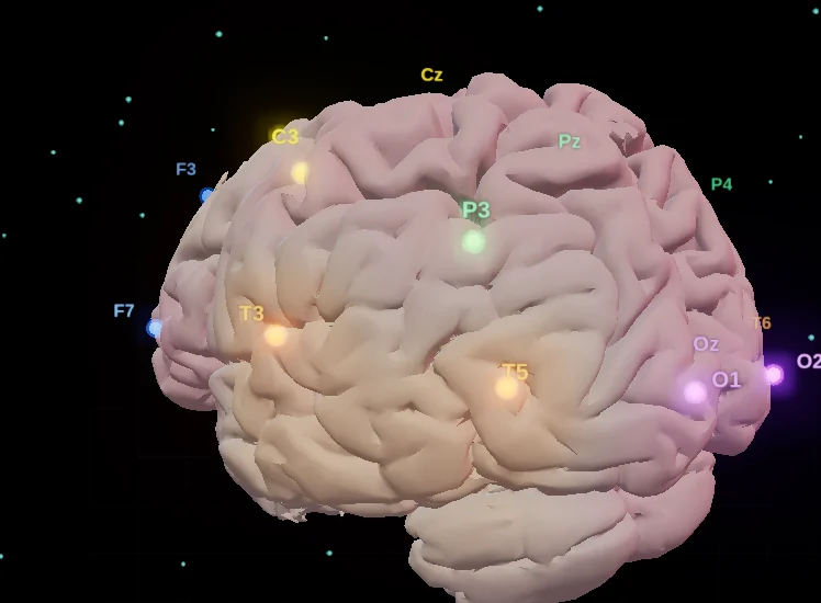 Devolutiva 3D: o cérebro que o paciente vê na tela